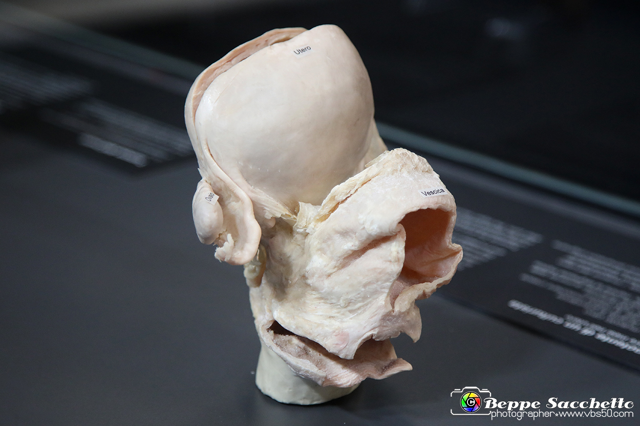 VBS_2549 - Utero - Mostra Body Worlds.jpg